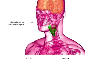 ¿Qué es la Disfonía Psicógena?