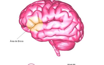 ¿Qué es la Afasia de Broca? Tratamiento