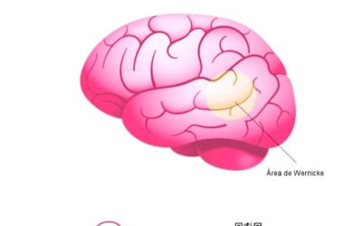 ¿Qué es la Afasia de Wernicke? Definición