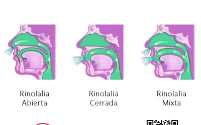 ¿Qué es la Rinolalia? Síntomas y Tratamiento