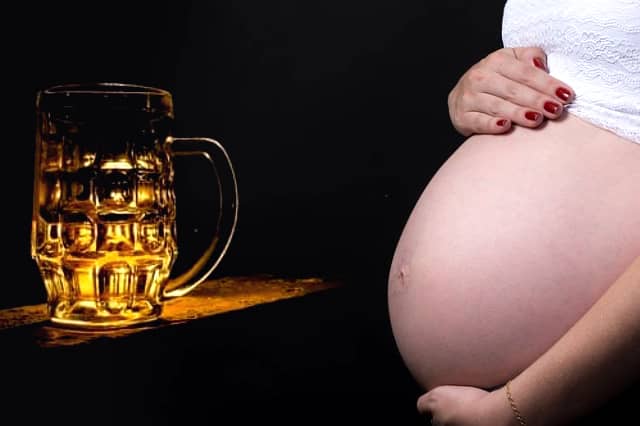 el síndrome alcohólico fetal